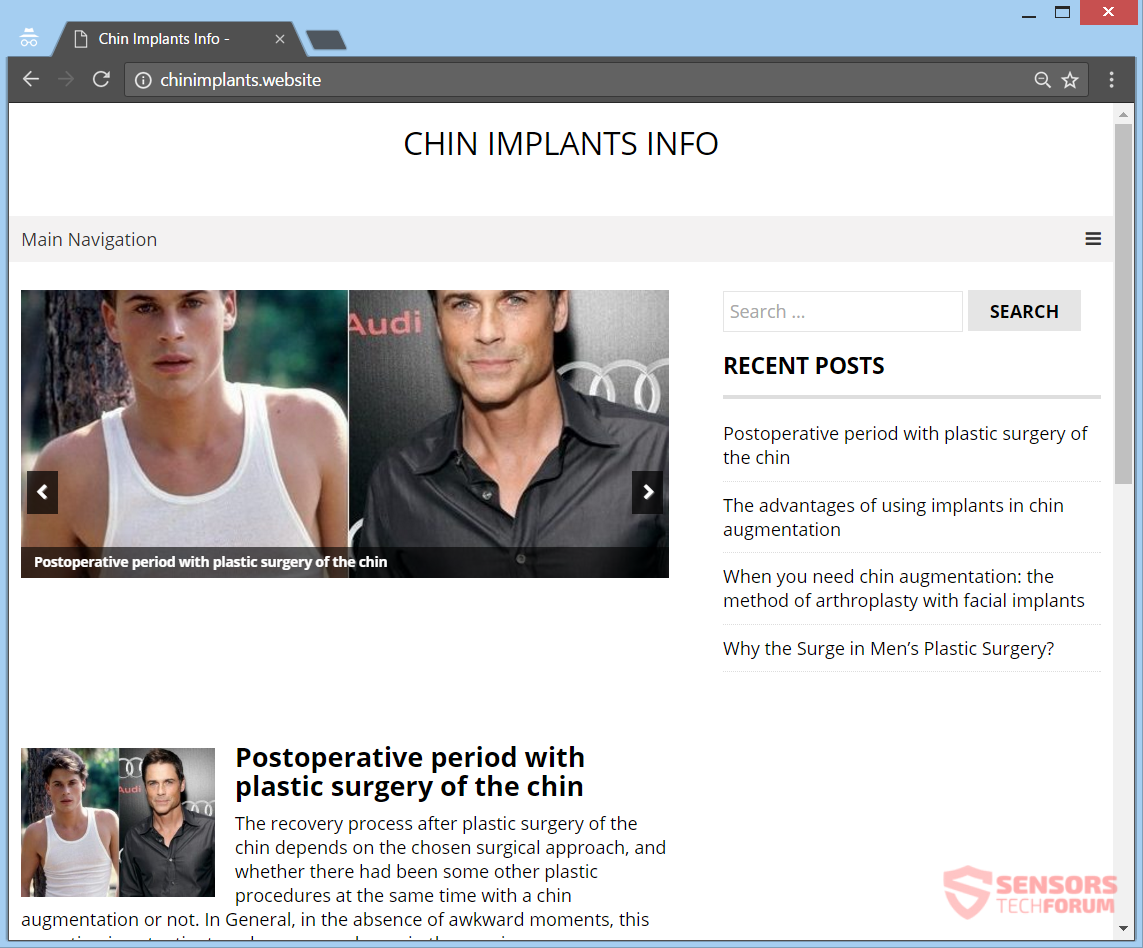 stf-chinimplants-website-chin-implants-ads-adware-main-web-page